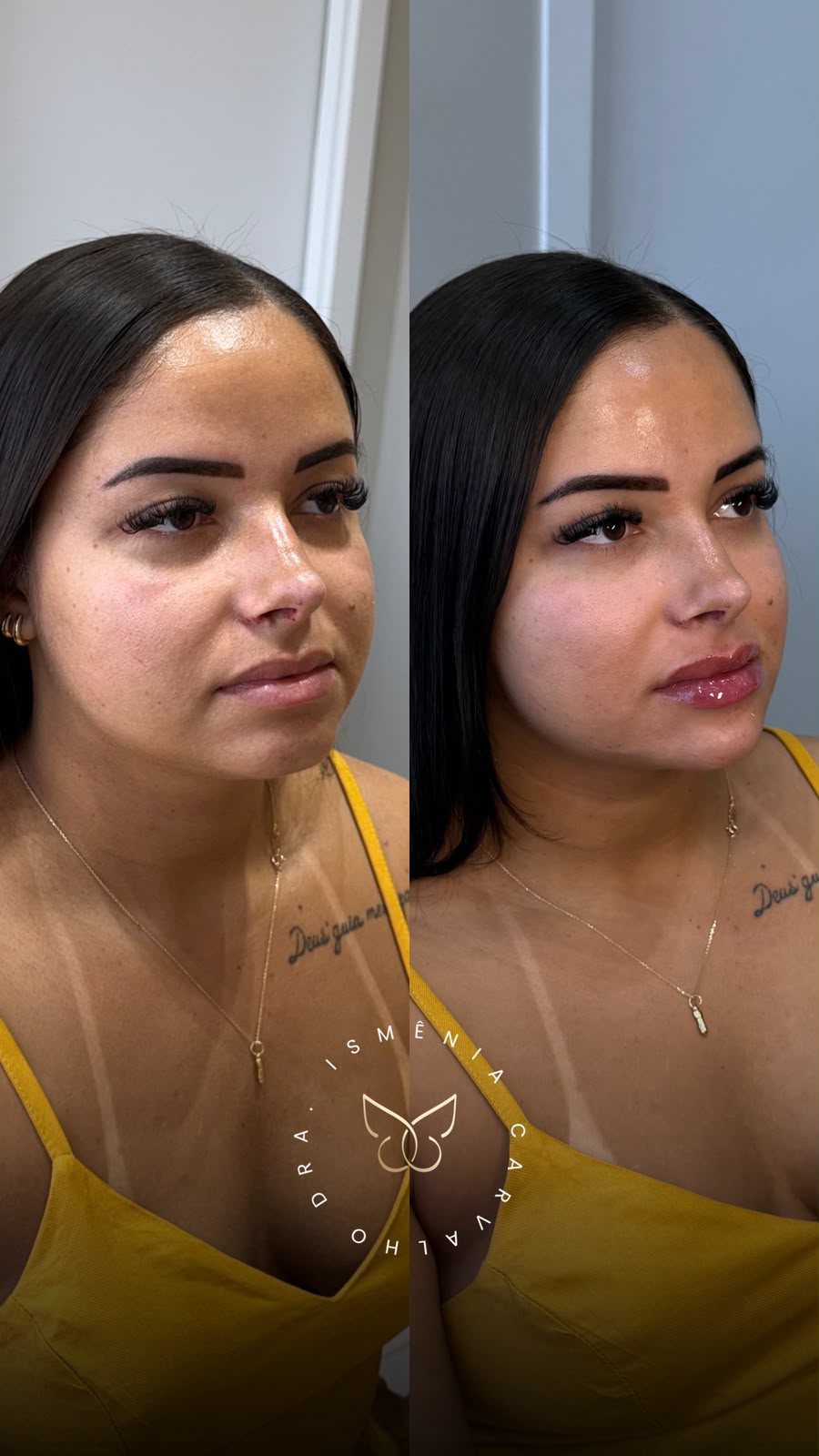Antes e depois de Face Sculpt